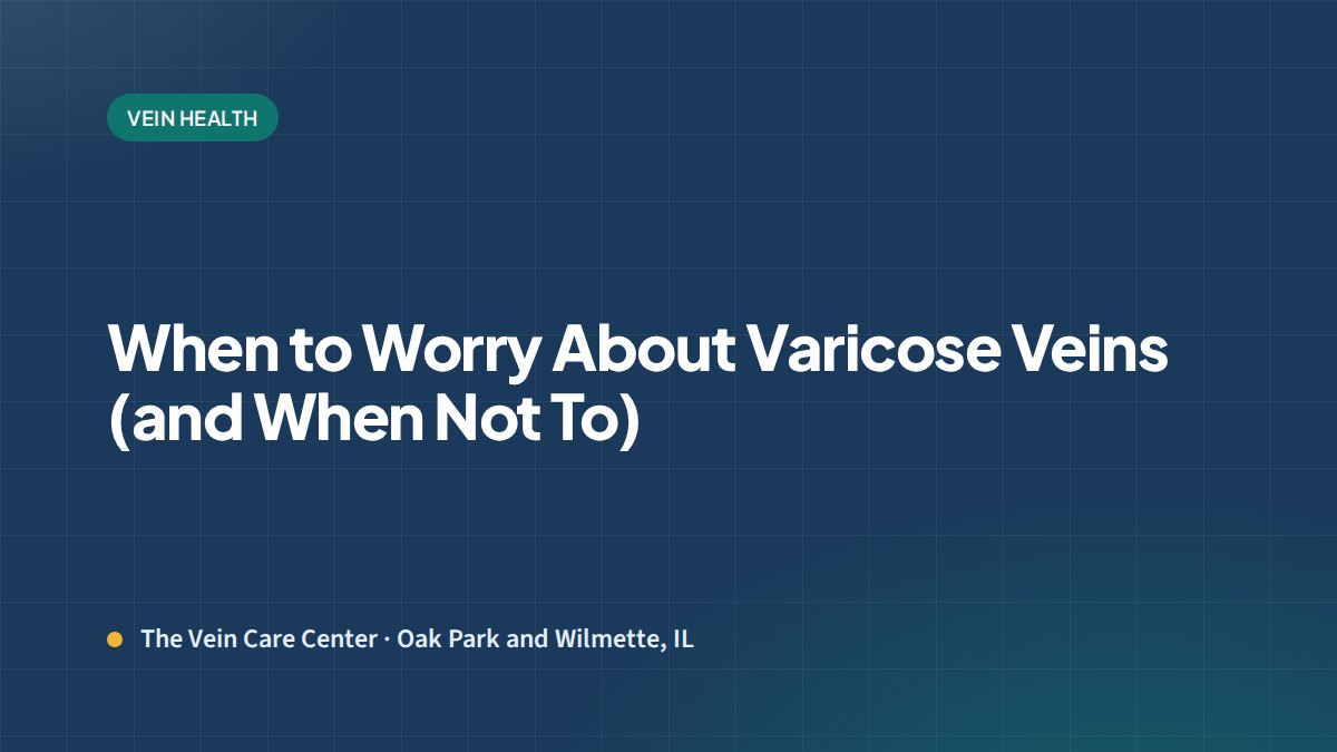 When to Worry About Varicose Veins (and When Not To)