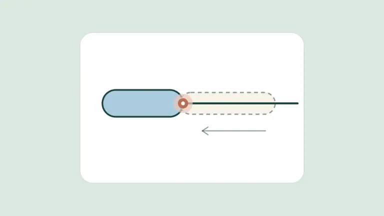 Diagram of a laser fiber sealing a vein from the inside