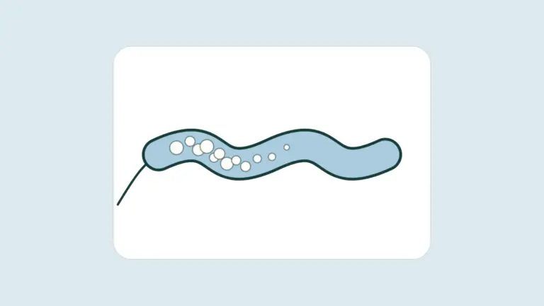 Diagram of foam filling a varicose vein from a thin catheter